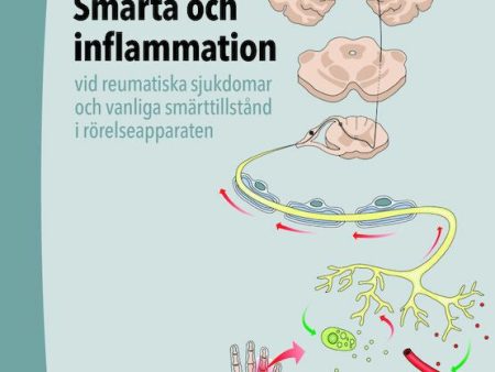 Smärta och inflammation - vid reumatiska sjukdomar och vanliga smärttillstånd i rörelseapparaten Fashion